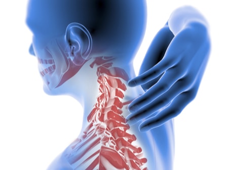 Neck Problems After a Car Accident: What You Need to Know